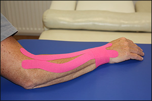 Kinesiologisches Taping